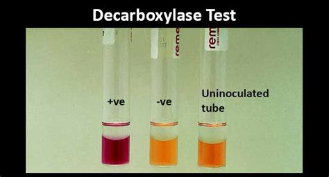lysine decarboxylase test results